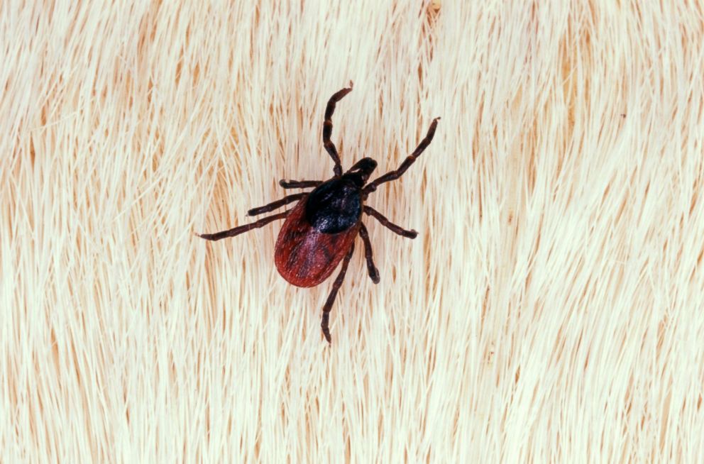 Health experts warn West Virginians to be on the lookout as tick populations increase